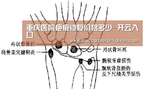 重庆医院疤痕修复价格多少-开云入口(图2) 开云电竞