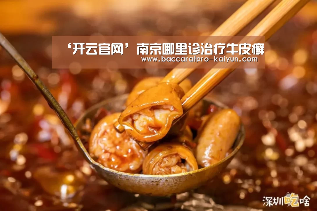 ‘开云官网’南京哪里诊治疗牛皮癣(图2) 开云官网